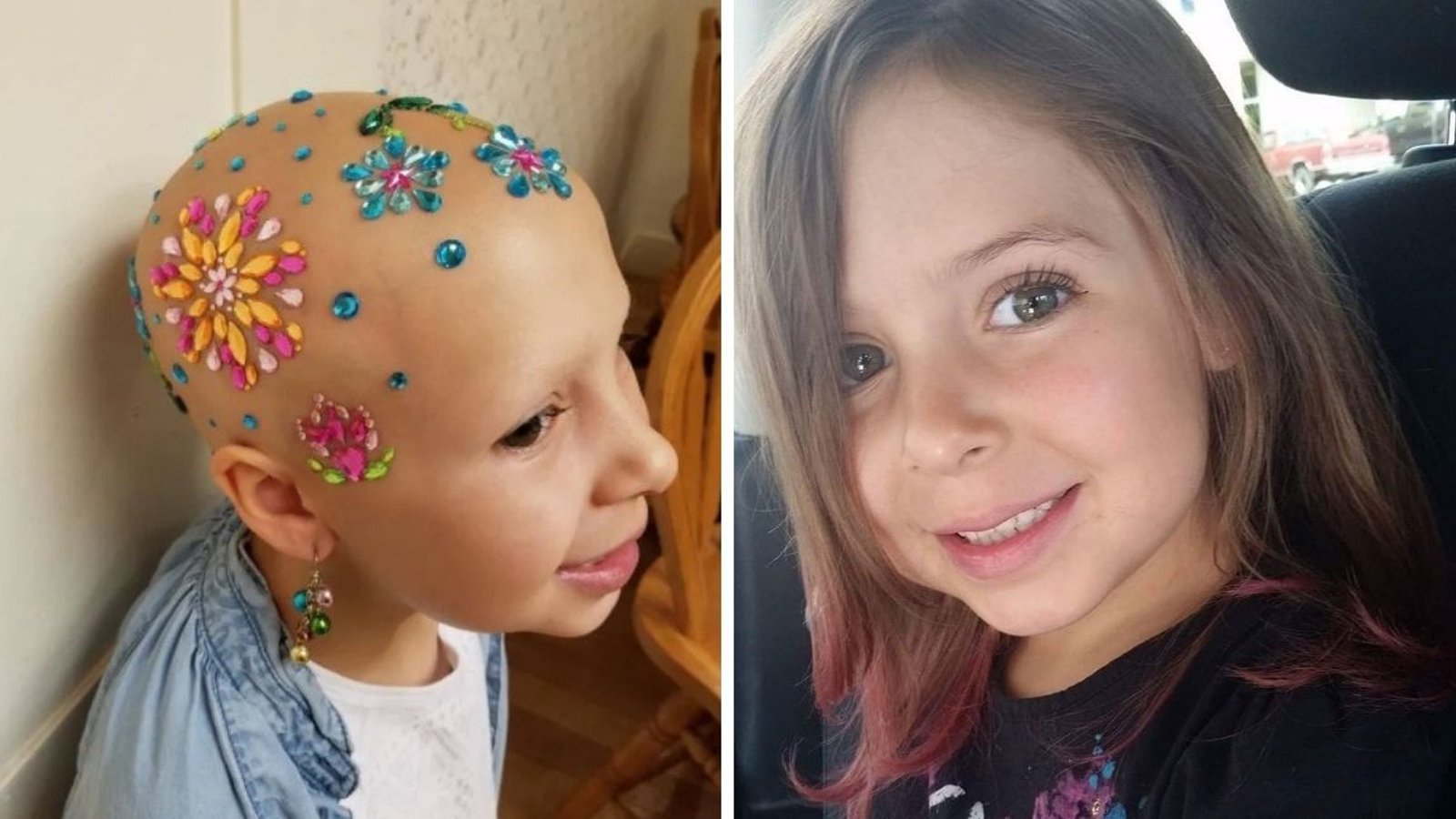 Cette fillette souffrant d'alopécie donne ses “astuces capillaires” pour les journées de coiffures folles à l'école