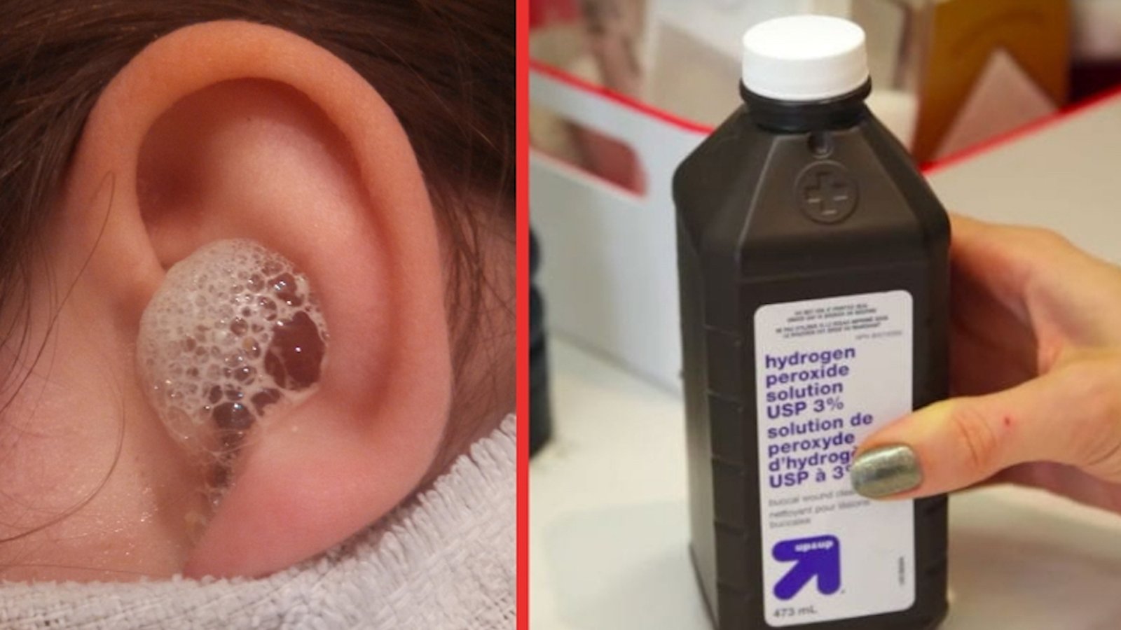 Voici comment utiliser le peroxyde d'hydrogène pour combattre les infections de l'oreille