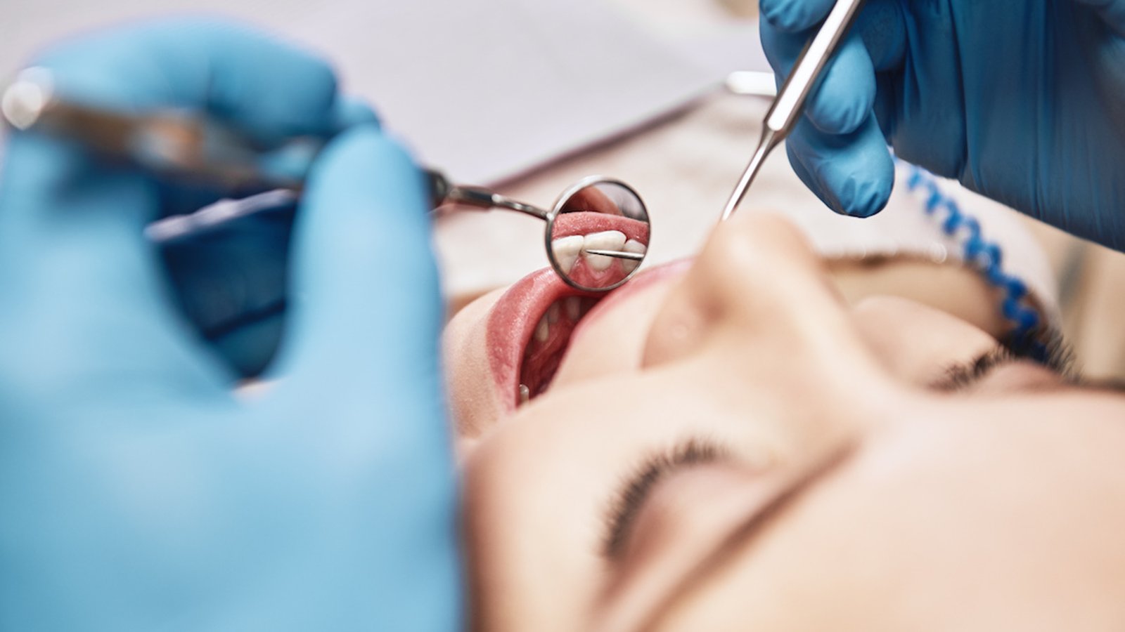 Deux dentistes déboulonnent 14 mythes au sujet des dents