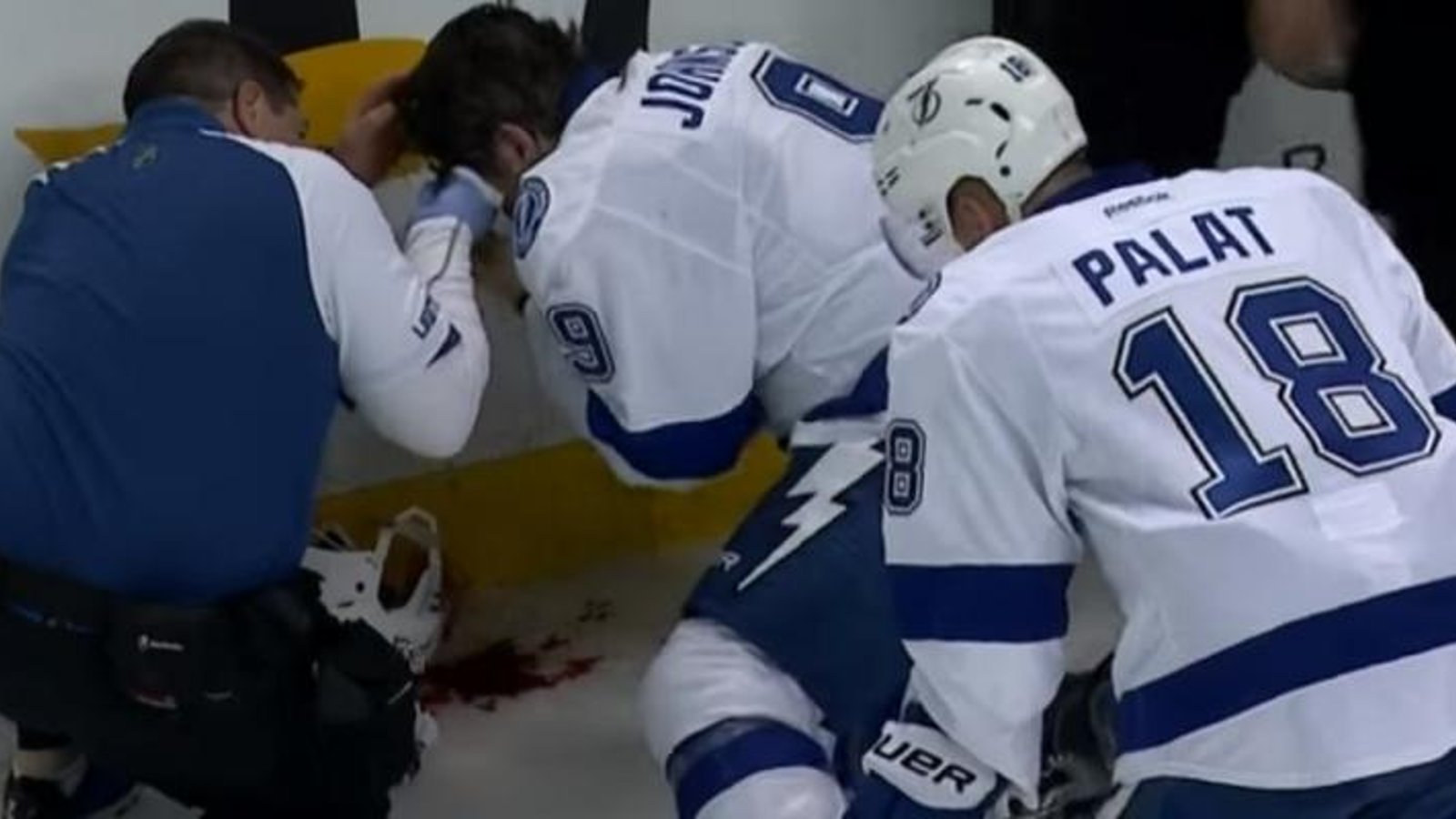 Tyler Johnson takes a shot to the face and is a bloody mess.
