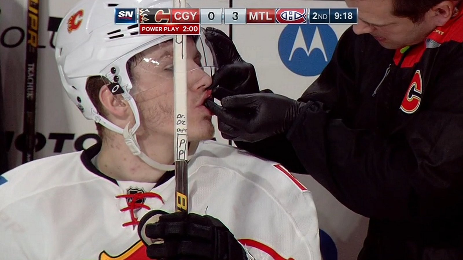 Tkachuk high-sticks himself in the face and a penalty is called!