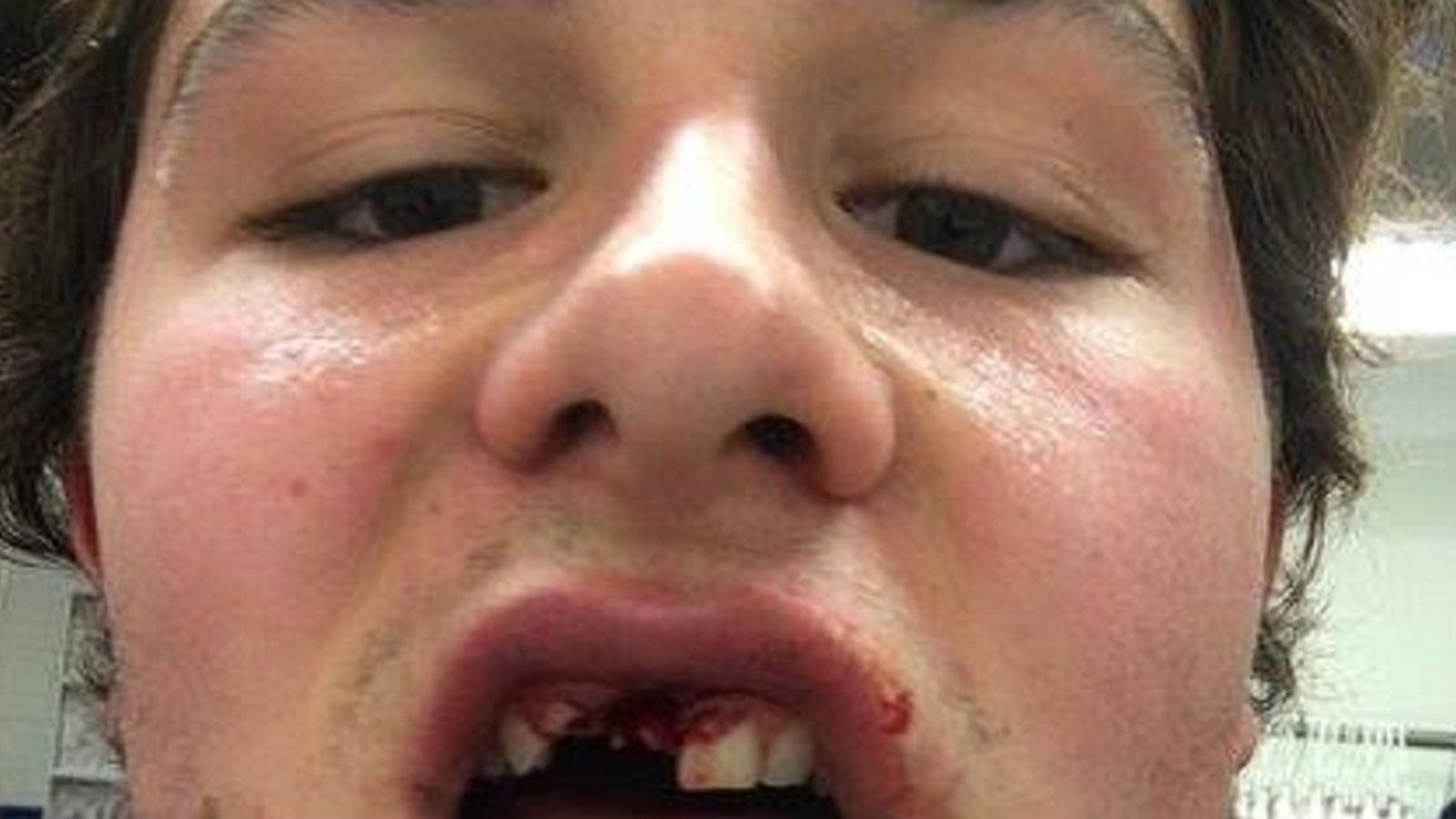 THIS is why you have to be tough to play hockey!! (PHOTO INSIDE!)