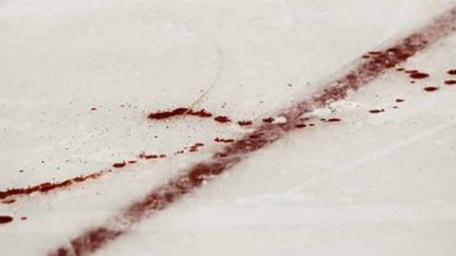 NHL forward leaves a trail of blood as he rushes off the ice with a nasty cut.