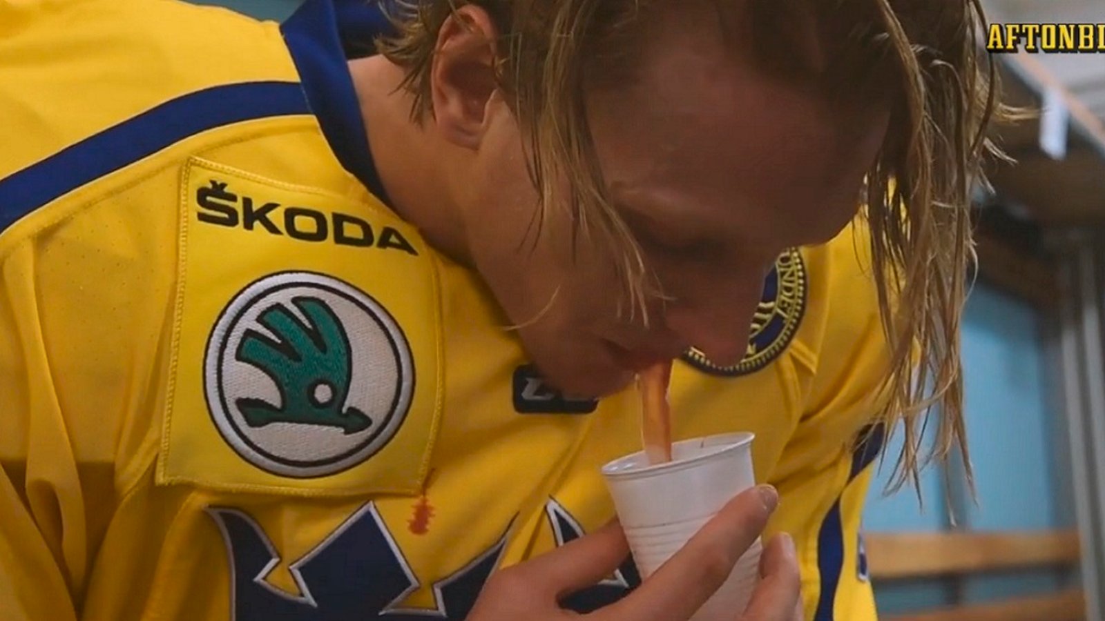 Brutal video shows NHL defenseman spitting out his teeth in the locker room.