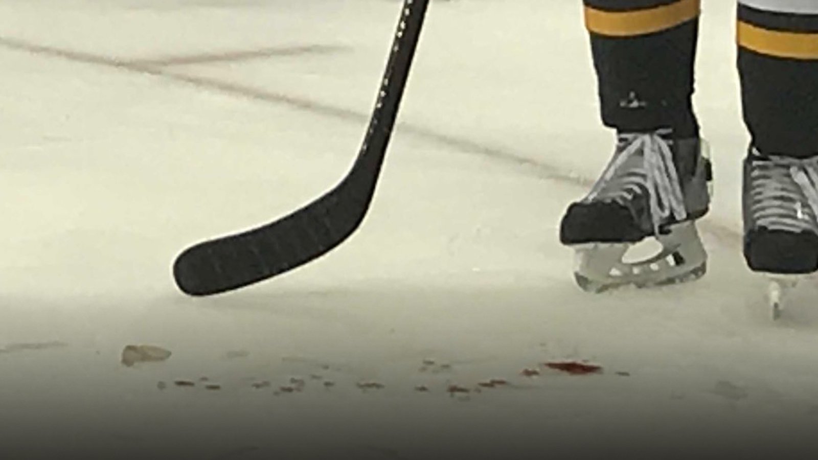 Must see: Gruesome injury leaves bloody mess on ice