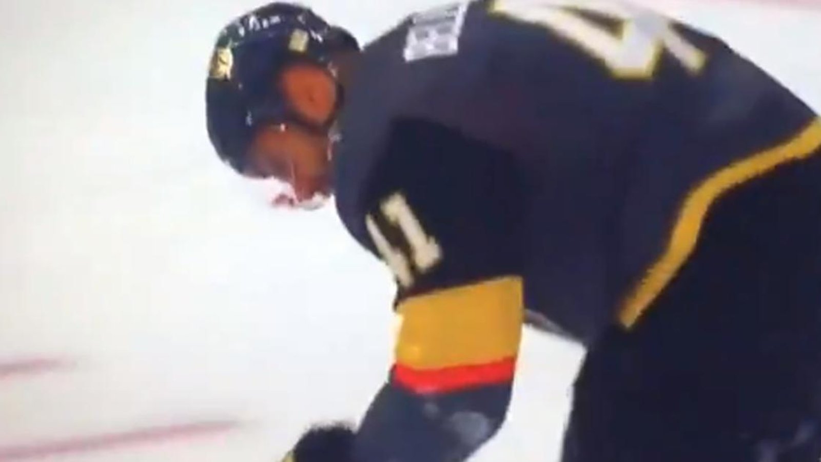 Breaking: Bellemare takes a puck to the face, leaves the ice a bloody mess