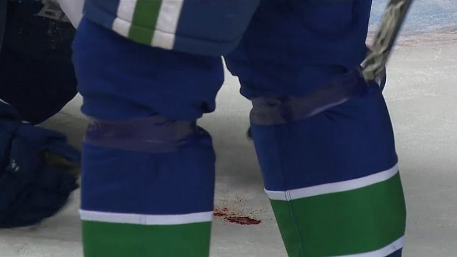 Defenseman leaves a bloody mess on the ice after taking a shot to the face.