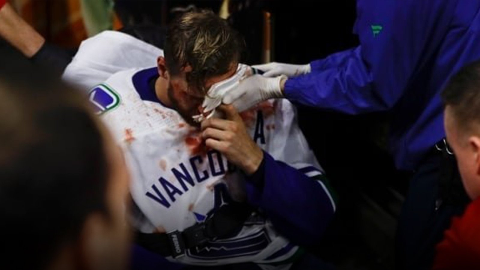 Outpouring of support for Canucks veteran Edler after terrifying injury in Philly last night