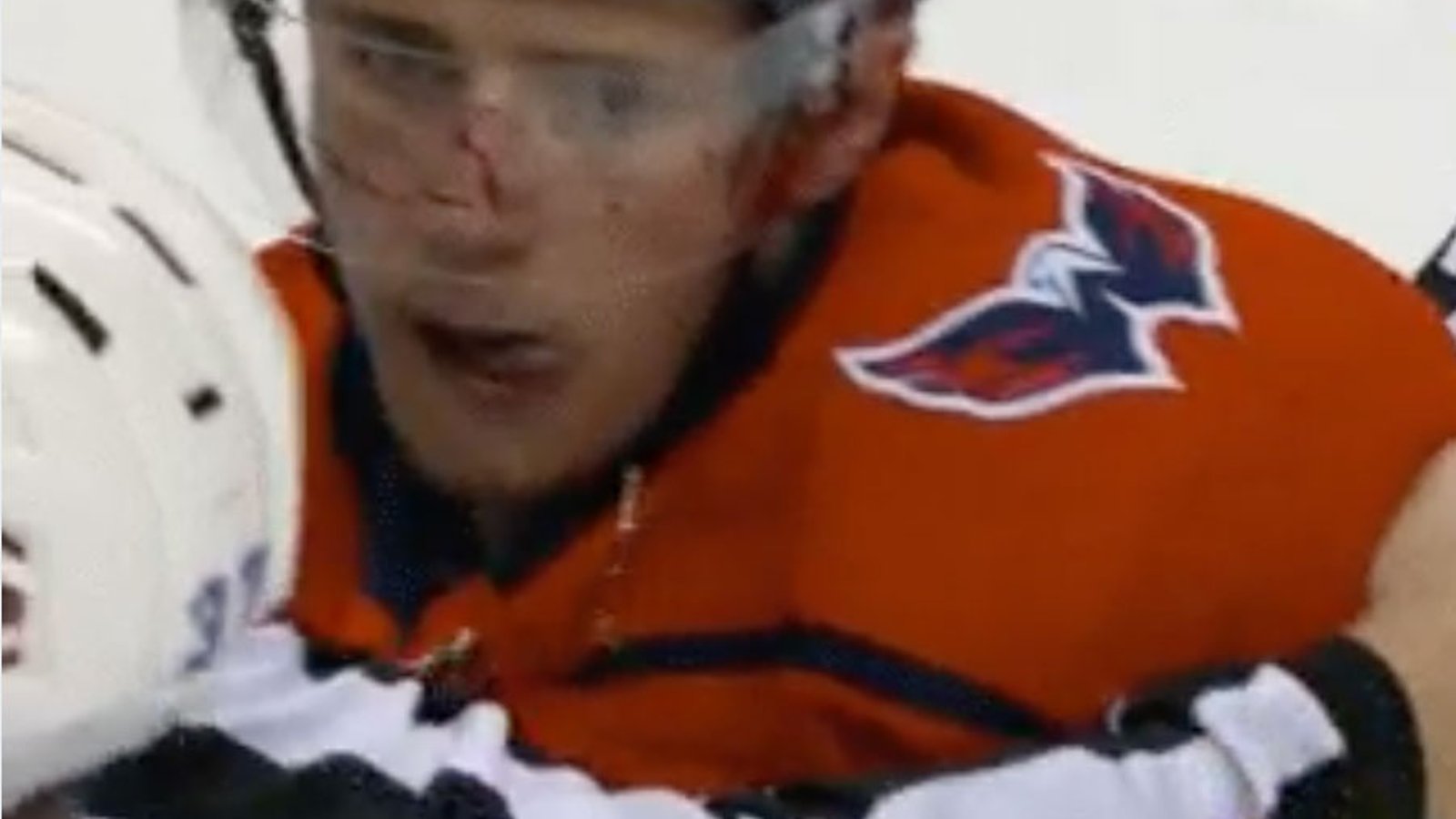 Second period fight escalates quickly and ends up in bloody line brawl! 
