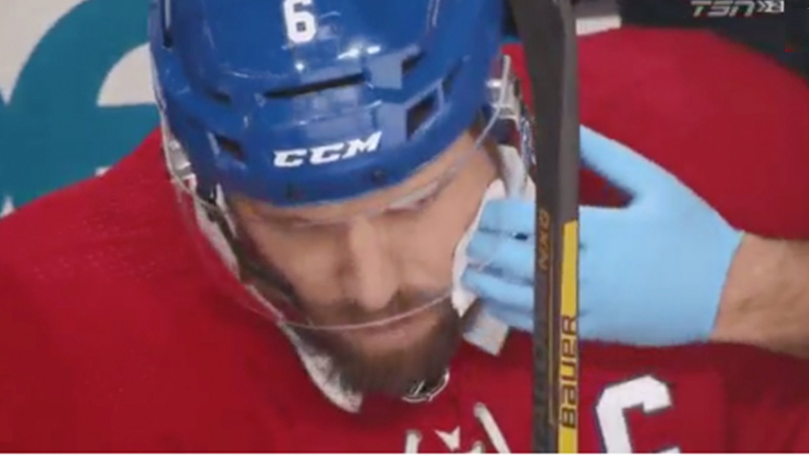 Shea Weber takes a puck to the face, is forced to leave the game