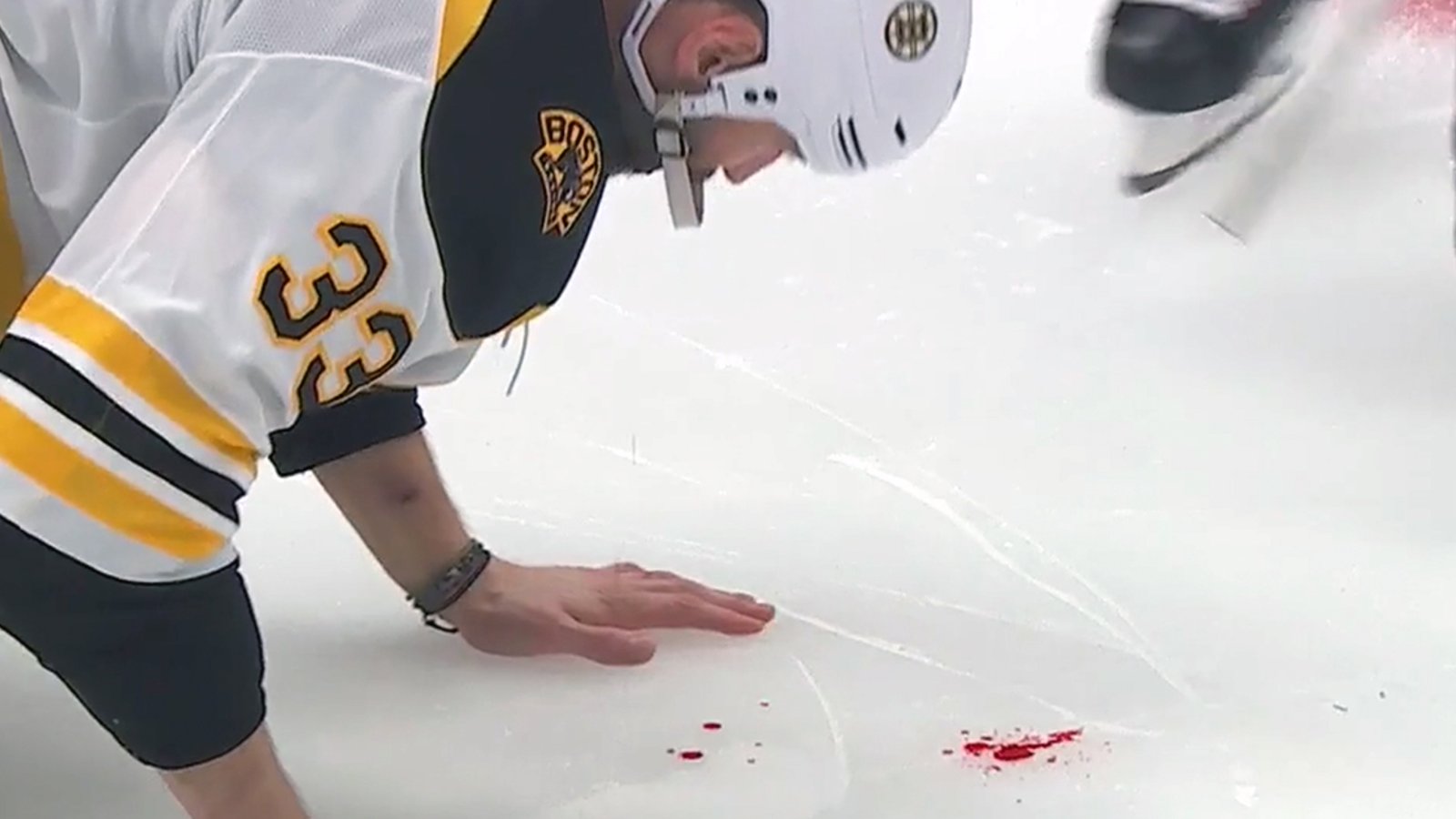 A bloody Zdeno Chara is forced to leave Game 4
