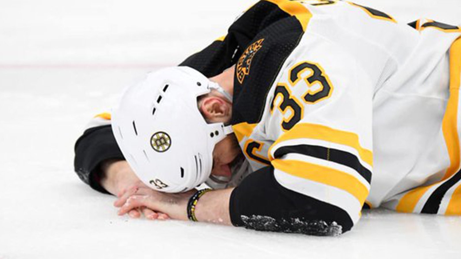 Report: Chara to play Game 5 with a broken jaw?!