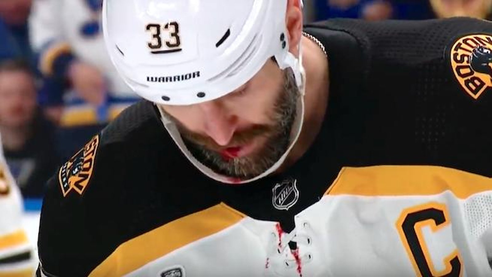 Gruesome details of Chara’s injury revealed! 