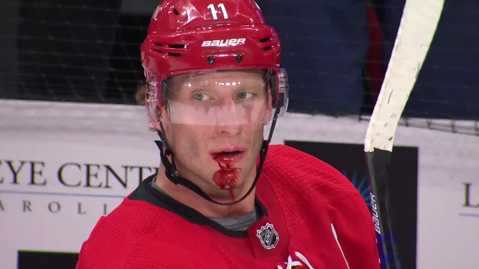 Jordan Staal busted open but goes unnoticed by NHL officials.