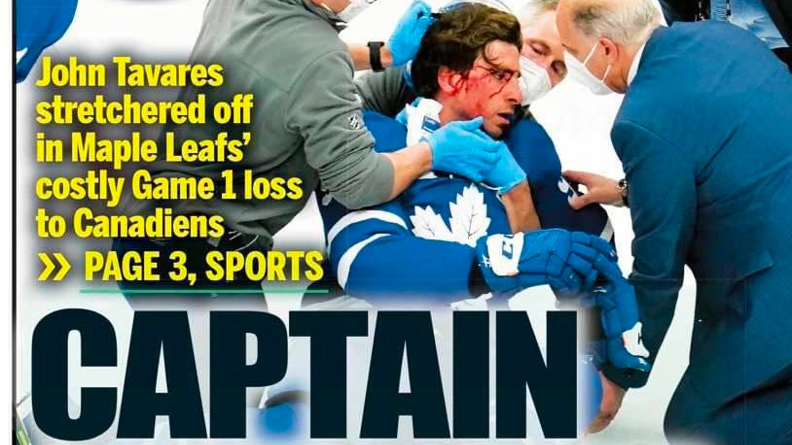Toronto Sun and other medias in hot water over treatment of Tavares’ injury 