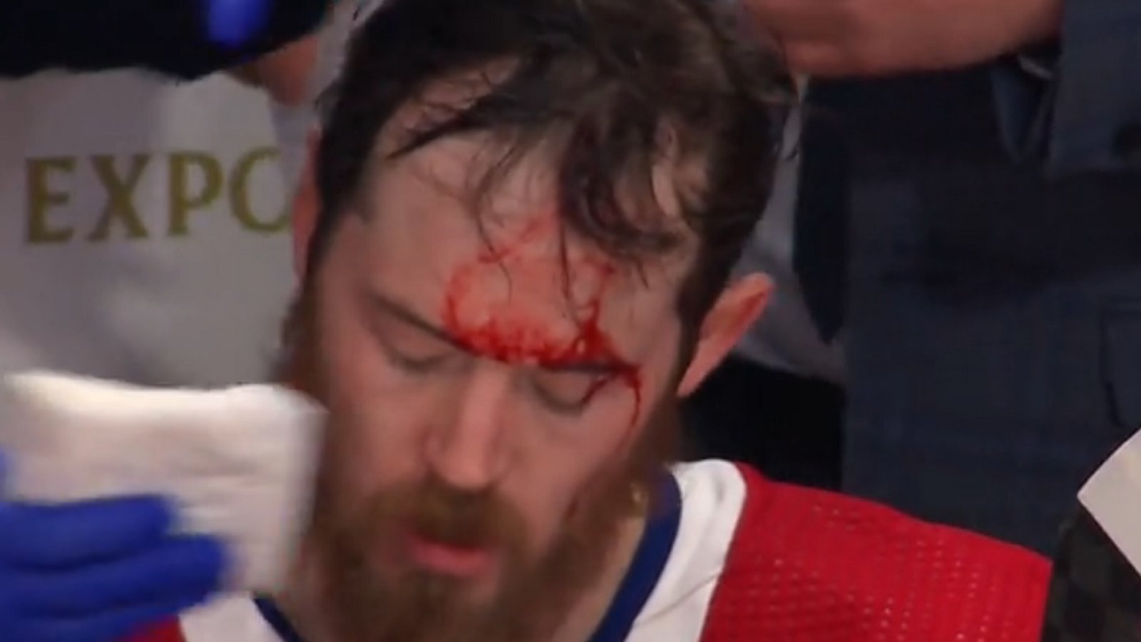 Paul Byron busted open after losing his helmet.